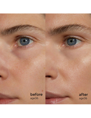 Retinol Alternative Sérum – Anti-âge naturel et sans irritation Retinol Alternative Sérum – Anti-âge naturel et sans irritation